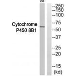 Western blot - Cytochrome P450 8B1 Antibody from Signalway Antibody (35273) - Antibodies.com