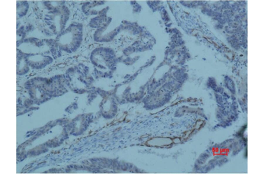 Immunohistochemistry - Survivin Monoclonal Antibody from Signalway Antibody (40488) - Antibodies.com