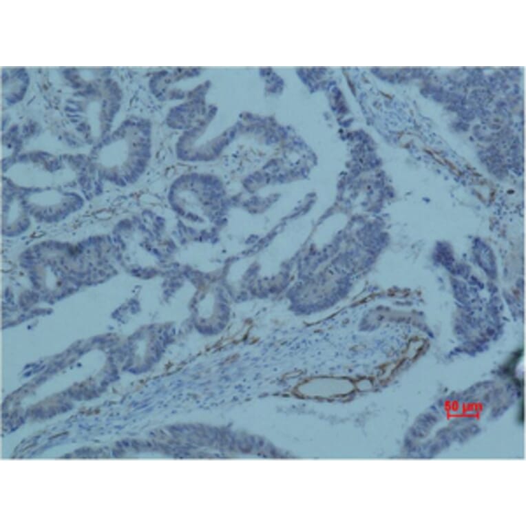 Immunohistochemistry - Survivin Monoclonal Antibody from Signalway Antibody (40488) - Antibodies.com