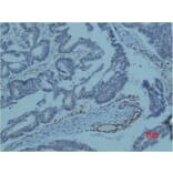 Immunohistochemistry - Survivin Monoclonal Antibody from Signalway Antibody (40488) - Antibodies.com