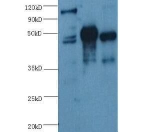 ENO2/NSE Monoclonal Antibody from Signalway Antibody (42020) - Antibodies.com