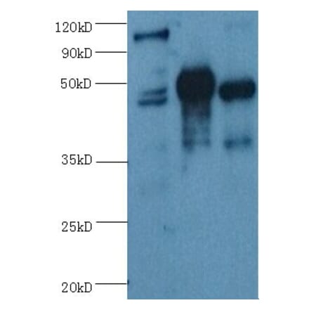 ENO2/NSE Monoclonal Antibody from Signalway Antibody (42020) - Antibodies.com
