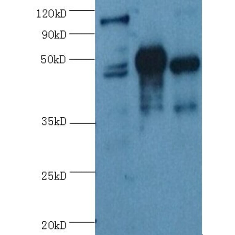 ENO2/NSE Monoclonal Antibody from Signalway Antibody (42020) - Antibodies.com