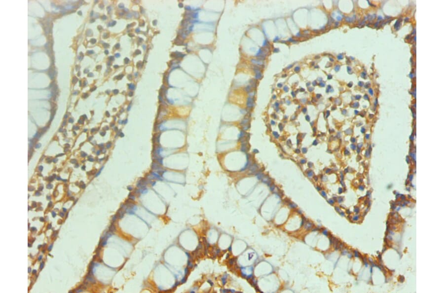 Immunohistochemistry - ENO2/NSE Monoclonal Antibody from Signalway Antibody (42020) - Antibodies.com