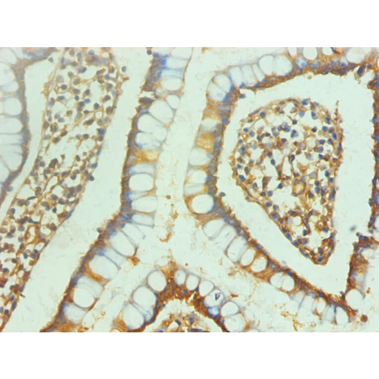 Immunohistochemistry - ENO2/NSE Monoclonal Antibody from Signalway Antibody (42020) - Antibodies.com
