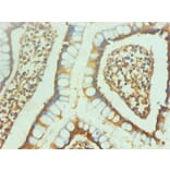 Immunohistochemistry - ENO2/NSE Monoclonal Antibody from Signalway Antibody (42020) - Antibodies.com