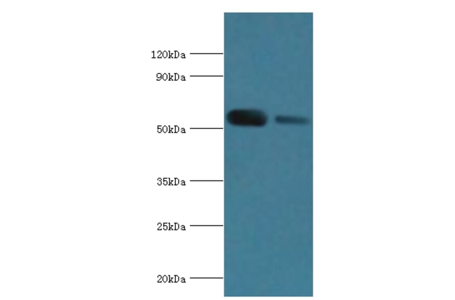 ATP6V1B1 Polyclonal Antibody from Signalway Antibody (42076) - Antibodies.com