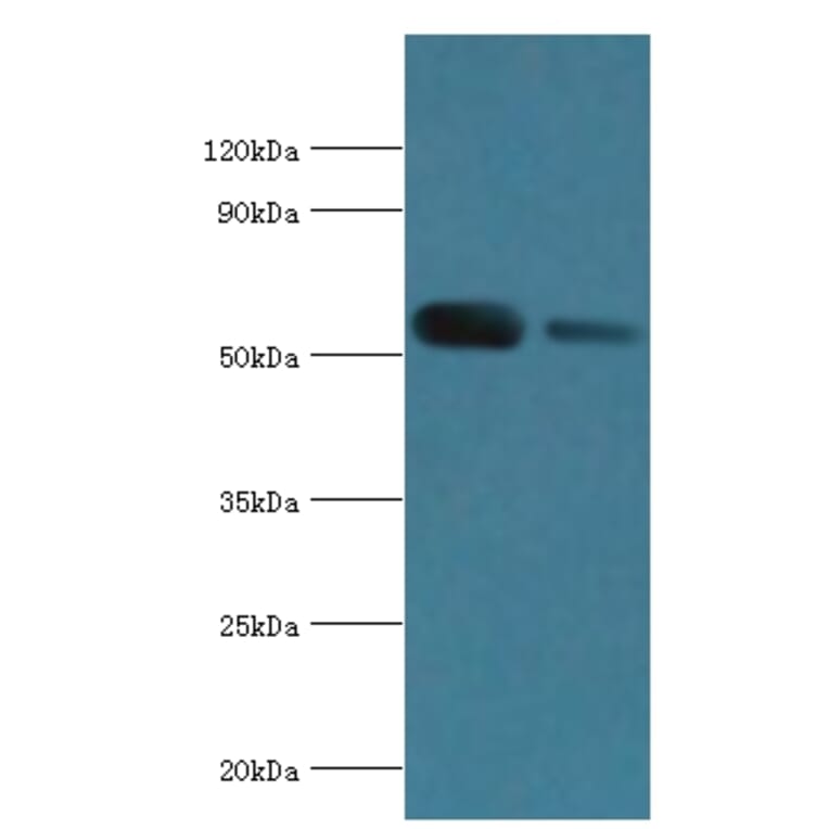 ATP6V1B1 Polyclonal Antibody from Signalway Antibody (42076) - Antibodies.com