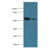 ATP6V1B1 Polyclonal Antibody from Signalway Antibody (42076) - Antibodies.com