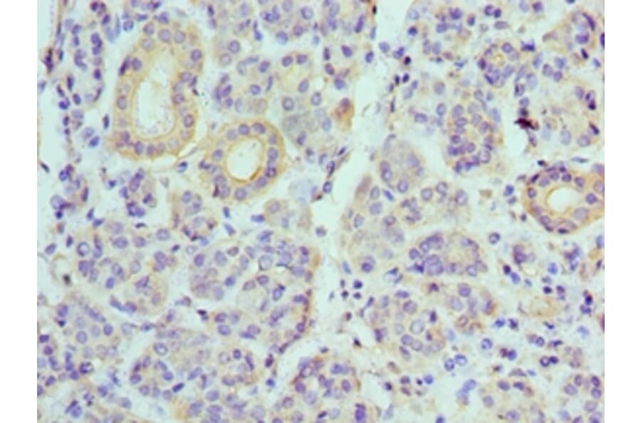 Immunohistochemistry - ATP6V1B1 Polyclonal Antibody from Signalway Antibody (42076) - Antibodies.com