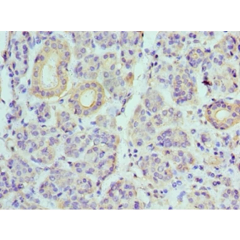 Immunohistochemistry - ATP6V1B1 Polyclonal Antibody from Signalway Antibody (42076) - Antibodies.com