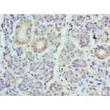 Immunohistochemistry - ATP6V1B1 Polyclonal Antibody from Signalway Antibody (42076) - Antibodies.com