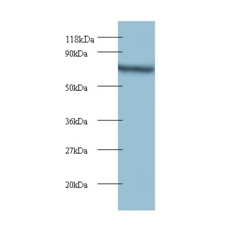 Tyrosyl-tRNA synthetase, cytoplasmic Polyclonal Antibody from Signalway Antibody (42104) - Antibodies.com