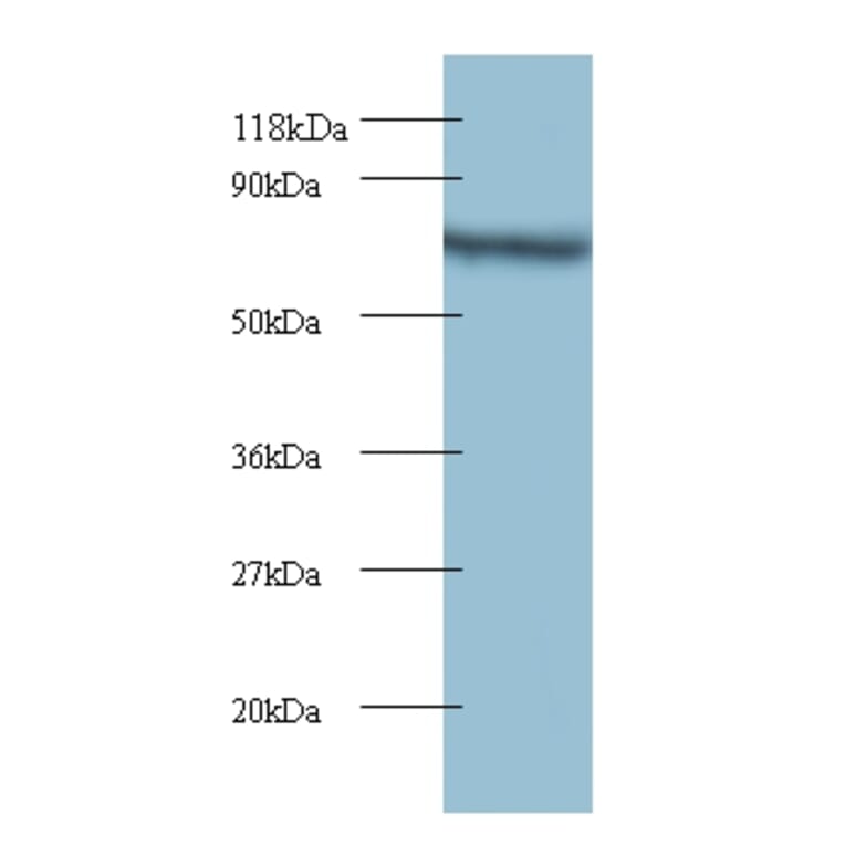 Tyrosyl-tRNA synthetase, cytoplasmic Polyclonal Antibody from Signalway Antibody (42104) - Antibodies.com