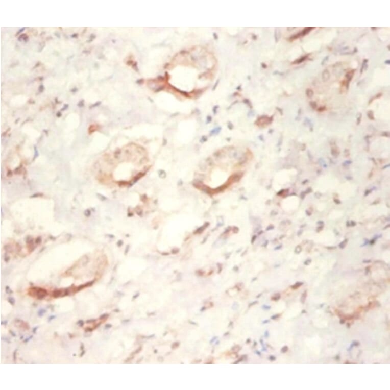 Immunohistochemistry - Tyrosyl-tRNA synthetase, cytoplasmic Polyclonal Antibody from Signalway Antibody (42104)