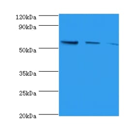 Western blot - Nicotinate phosphoribosyltransferase Polyclonal Antibody from Signalway Antibody - Antibodies.com