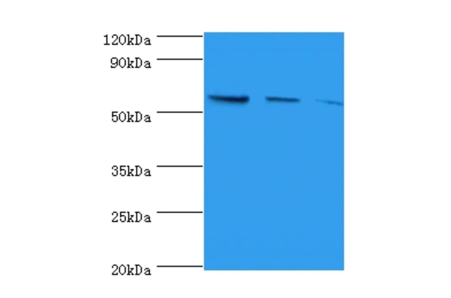 Western blot - Nicotinate phosphoribosyltransferase Polyclonal Antibody from Signalway Antibody - Antibodies.com