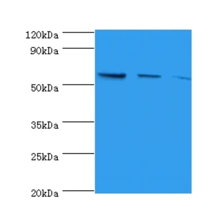 Western blot - Nicotinate phosphoribosyltransferase Polyclonal Antibody from Signalway Antibody - Antibodies.com