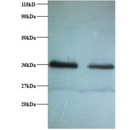 Replication protein A 32 kDa subunit Polyclonal Antibody from Signalway Antibody (42269) - Antibodies.com