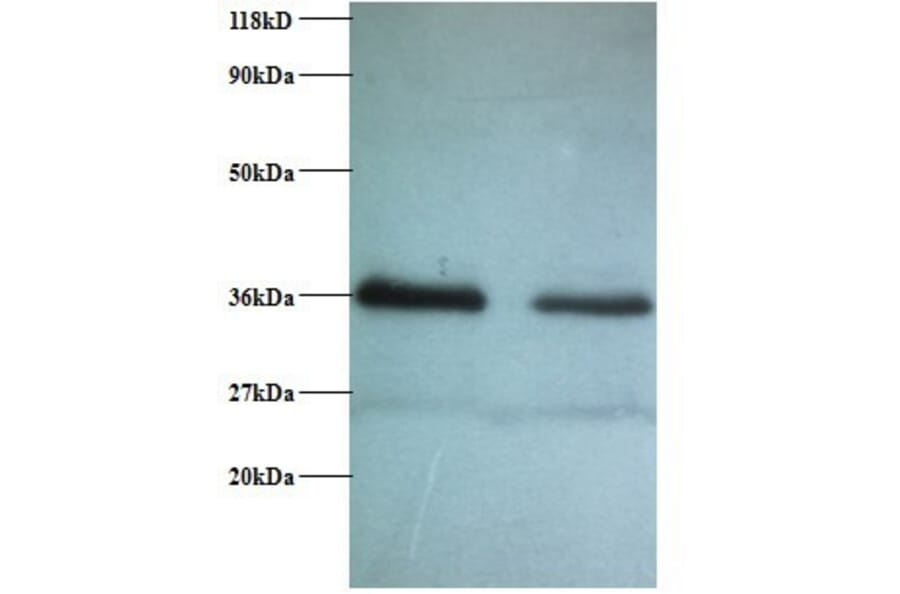 Replication protein A 32 kDa subunit Polyclonal Antibody from Signalway Antibody (42269) - Antibodies.com