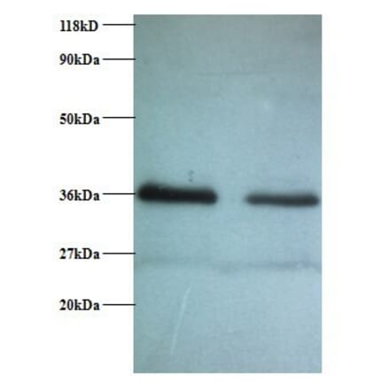 Replication protein A 32 kDa subunit Polyclonal Antibody from Signalway Antibody (42269) - Antibodies.com