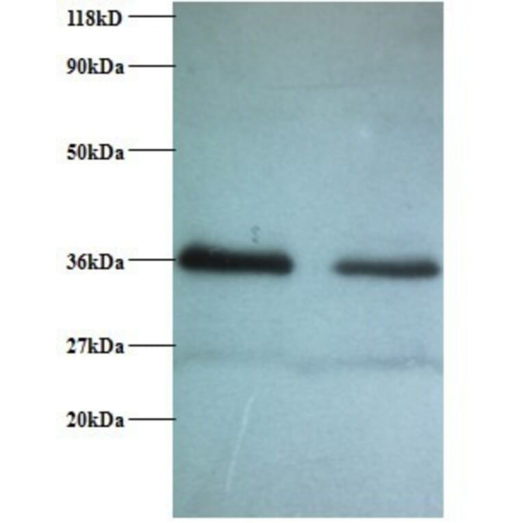 Replication protein A 32 kDa subunit Polyclonal Antibody from Signalway Antibody (42269) - Antibodies.com