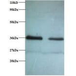 Replication protein A 32 kDa subunit Polyclonal Antibody from Signalway Antibody (42269) - Antibodies.com