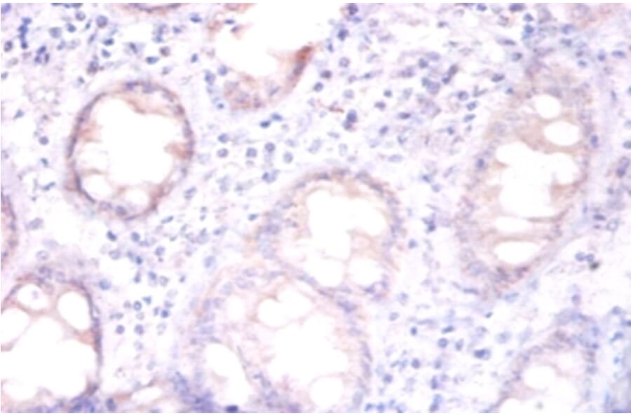 Immunohistochemistry - Replication protein A 32 kDa subunit Polyclonal Antibody from Signalway Antibody (42269)