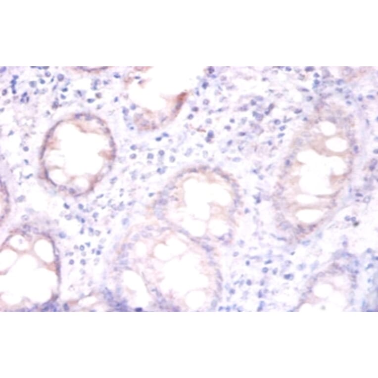 Immunohistochemistry - Replication protein A 32 kDa subunit Polyclonal Antibody from Signalway Antibody (42269)