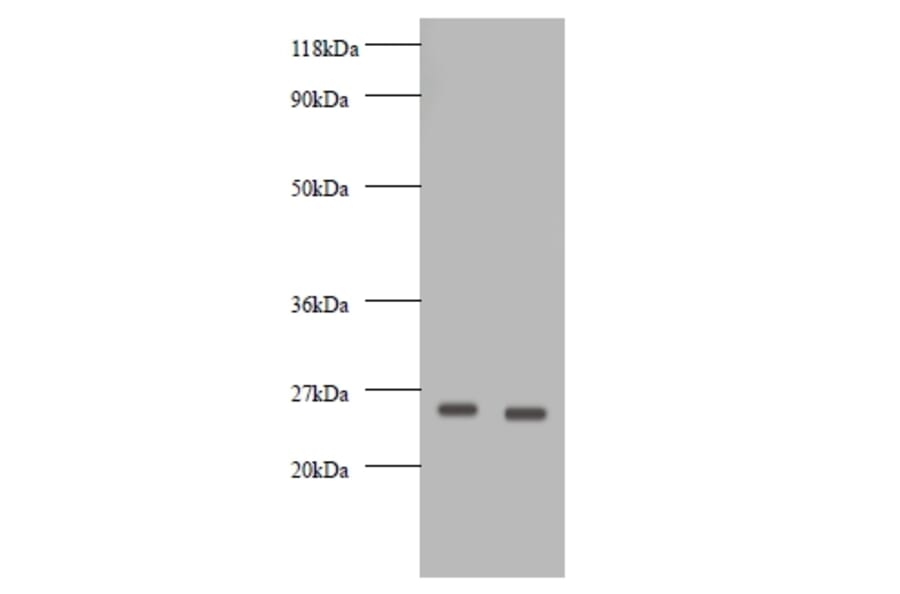 Vascular endothelial growth factor A Polyclonal Antibody from Signalway Antibody (42500) - Antibodies.com