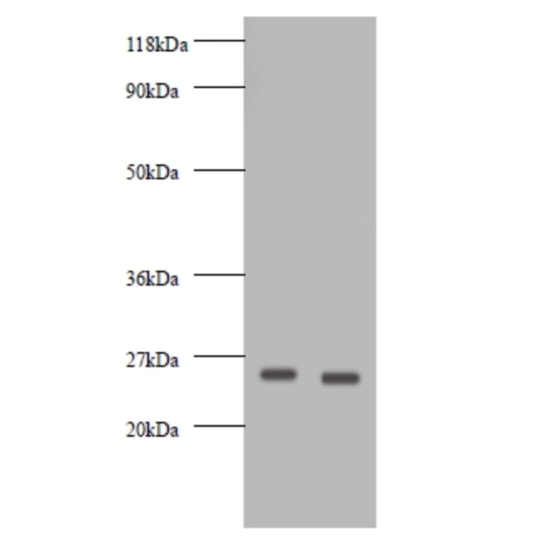 Vascular endothelial growth factor A Polyclonal Antibody from Signalway Antibody (42500) - Antibodies.com