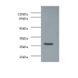 Vascular endothelial growth factor A Polyclonal Antibody from Signalway Antibody (42500) - Antibodies.com