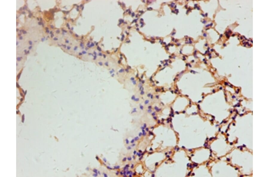 Immunohistochemistry - Vascular endothelial growth factor A Polyclonal Antibody from Signalway Antibody (42500)