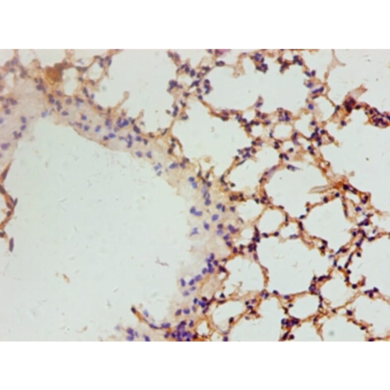 Immunohistochemistry - Vascular endothelial growth factor A Polyclonal Antibody from Signalway Antibody (42500)