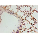 Immunohistochemistry - Vascular endothelial growth factor A Polyclonal Antibody from Signalway Antibody (42500)