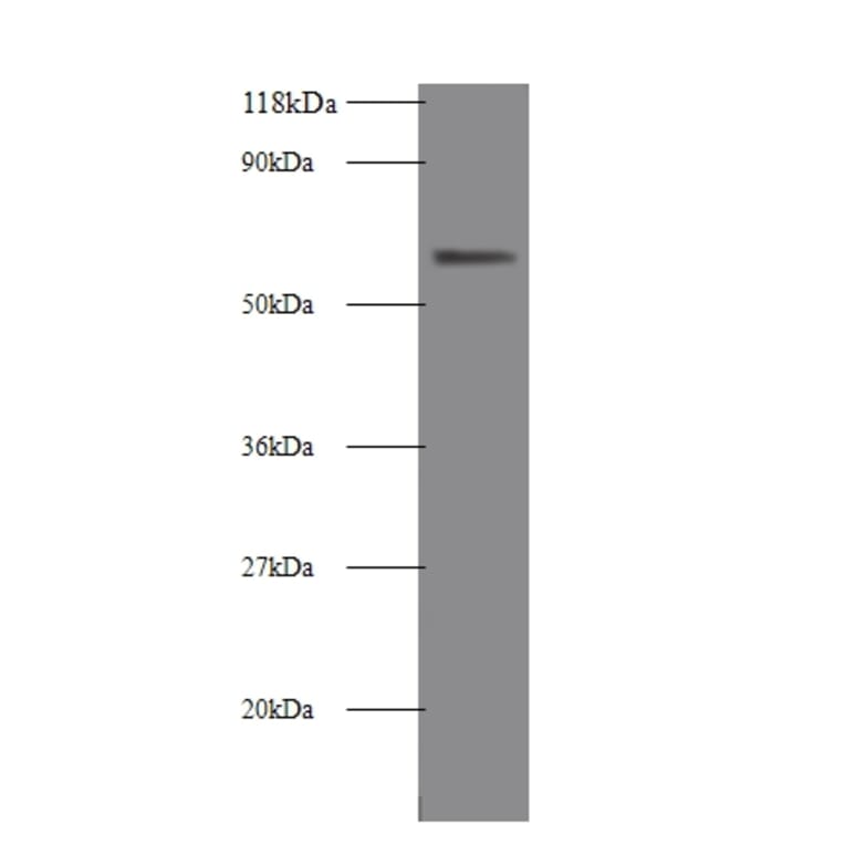 Intestinal-type alkaline phosphatase Polyclonal Antibody from Signalway Antibody (42554) - Antibodies.com