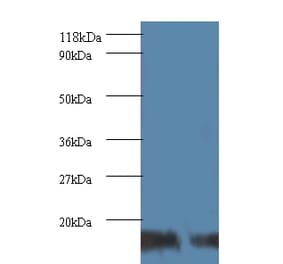 SUMO-conjugating enzyme UBC9 Polyclonal Antibody from Signalway Antibody (42105) - Antibodies.com