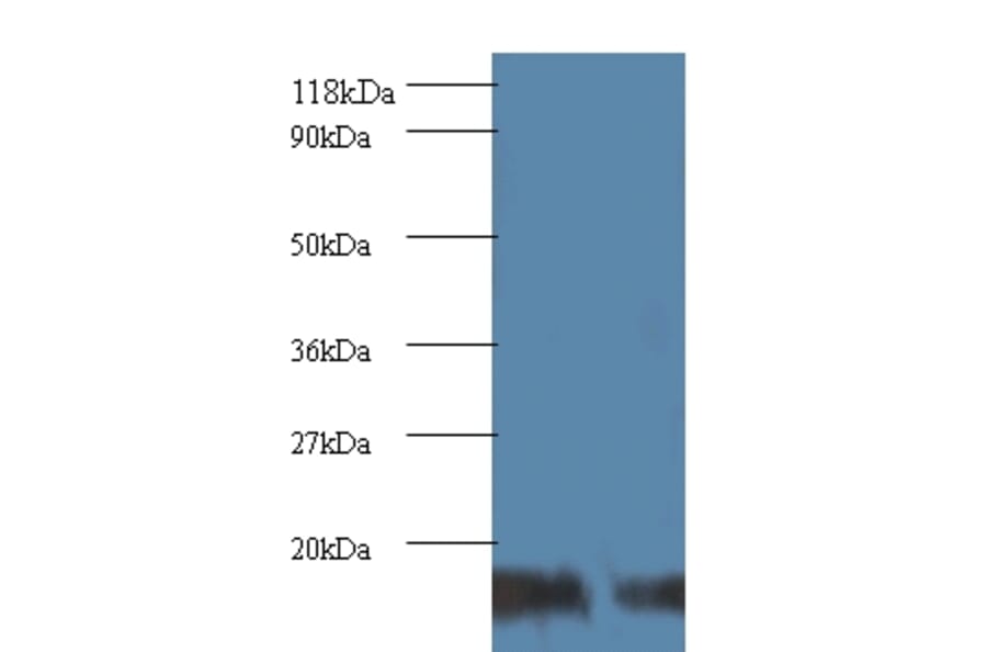 SUMO-conjugating enzyme UBC9 Polyclonal Antibody from Signalway Antibody (42105) - Antibodies.com