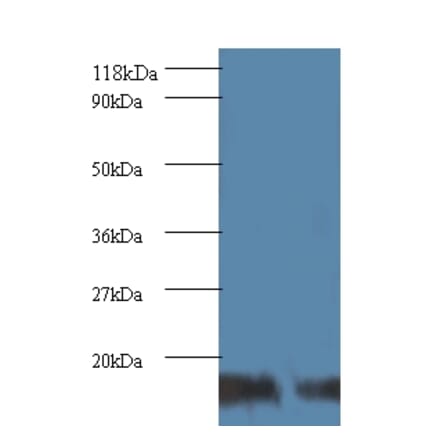 SUMO-conjugating enzyme UBC9 Polyclonal Antibody from Signalway Antibody (42105) - Antibodies.com