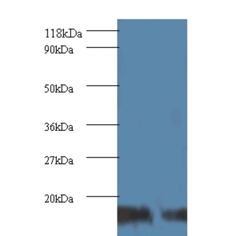 SUMO-conjugating enzyme UBC9 Polyclonal Antibody from Signalway Antibody (42105) - Antibodies.com