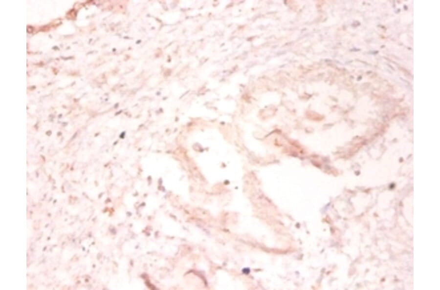 Immunohistochemistry - SUMO-conjugating enzyme UBC9 Polyclonal Antibody from Signalway Antibody - Antibodies.com