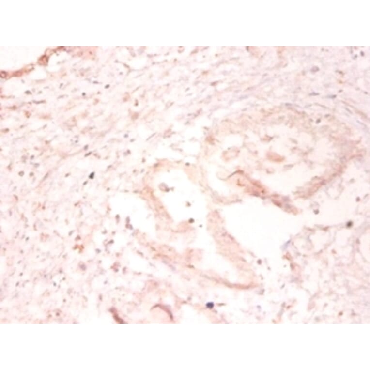 Immunohistochemistry - SUMO-conjugating enzyme UBC9 Polyclonal Antibody from Signalway Antibody - Antibodies.com