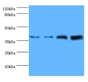 Western blot - Tubulin-specific chaperone C Polyclonal Antibody from Signalway Antibody (42341) - Antibodies.com