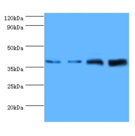 Western blot - Tubulin-specific chaperone C Polyclonal Antibody from Signalway Antibody (42341) - Antibodies.com