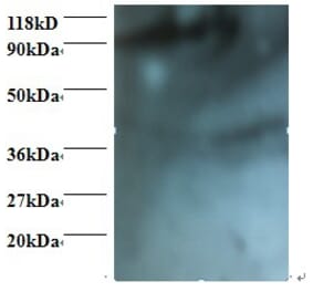 HCLS1-associated protein X-1 Polyclonal Antibody from Signalway Antibody (42396) - Antibodies.com
