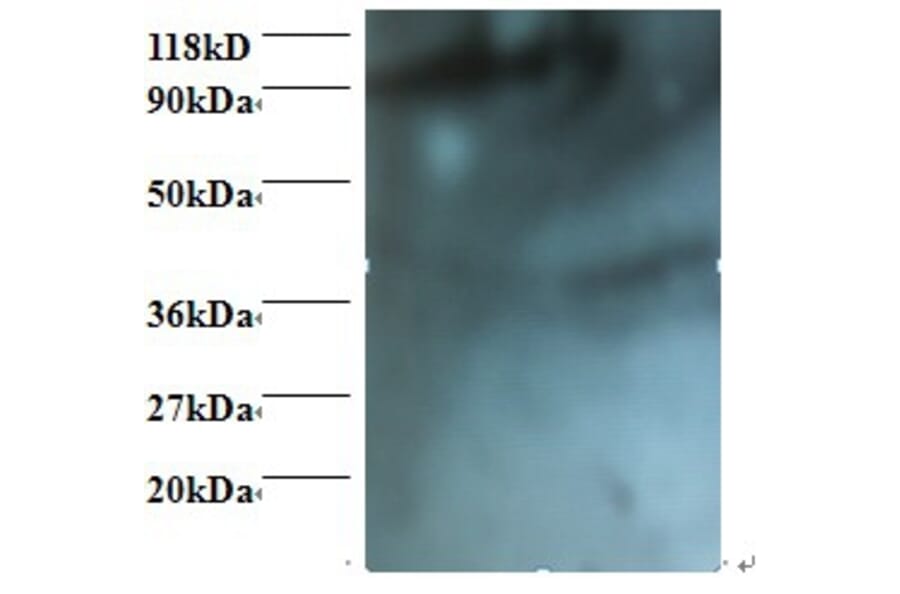 HCLS1-associated protein X-1 Polyclonal Antibody from Signalway Antibody (42396) - Antibodies.com