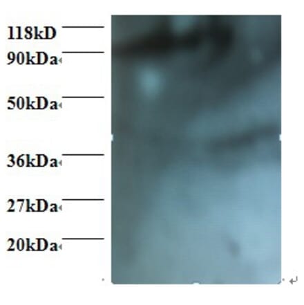 HCLS1-associated protein X-1 Polyclonal Antibody from Signalway Antibody (42396) - Antibodies.com