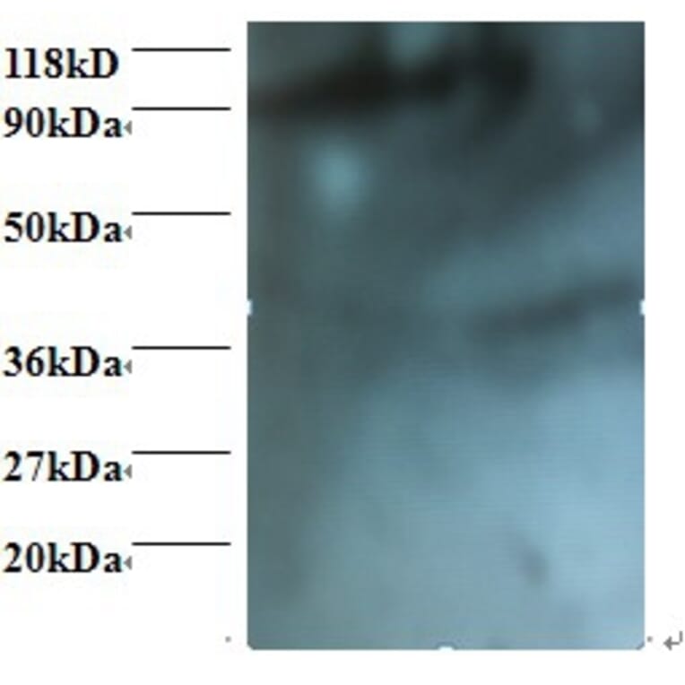 HCLS1-associated protein X-1 Polyclonal Antibody from Signalway Antibody (42396) - Antibodies.com
