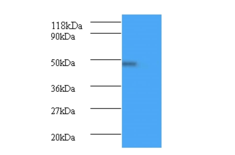 Bone morphogenetic protein 7 Polyclonal Antibody from Signalway Antibody (42441) - Antibodies.com