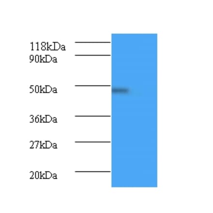 Bone morphogenetic protein 7 Polyclonal Antibody from Signalway Antibody (42441) - Antibodies.com